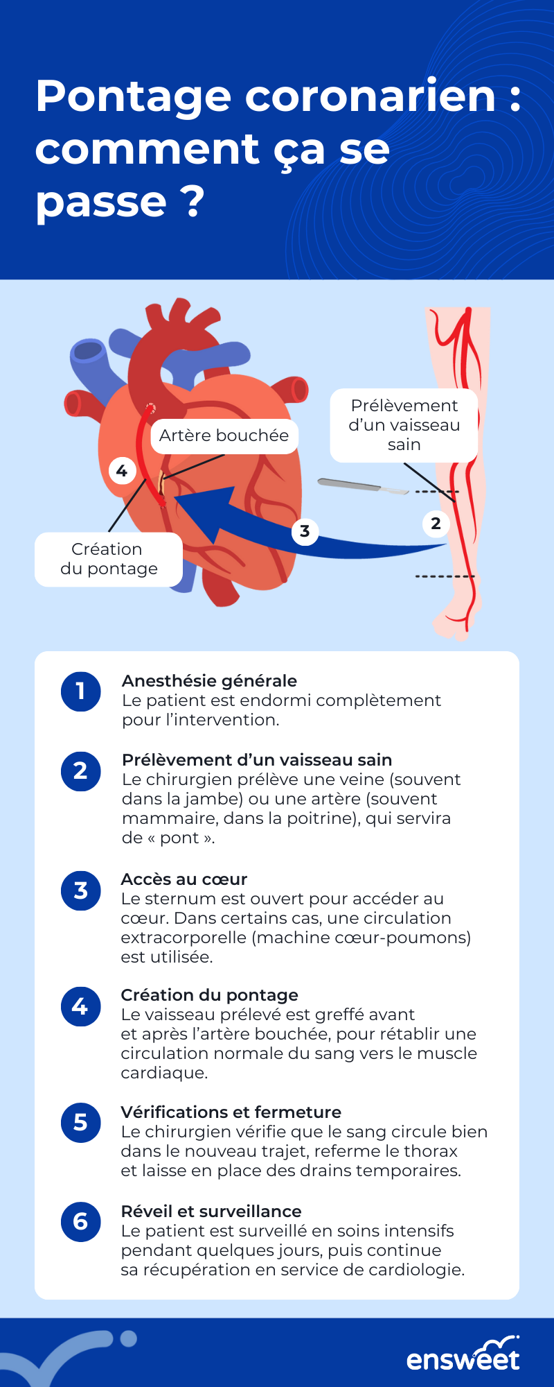 6. Les étapes d’un pontage coronarien.png
